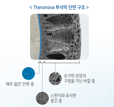 Theranova 투석막 단면 구조